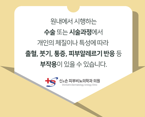 팝업이미지